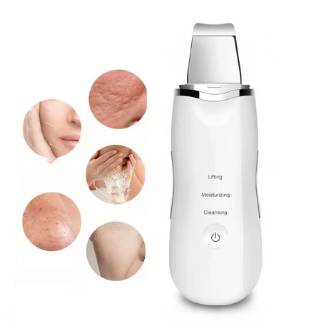 Aparelho de Peeling Ultrassônico Limpador Facial Anti-rugas Sonic Skin Ionização SM03