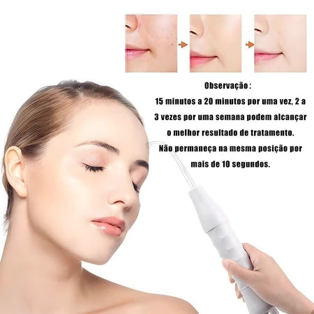 Aparelho Alta Frequência Portátil Para Limpeza De Pele Tratamento Facial e Capilar 4 Eletrodos Eletroterapia Bivolt